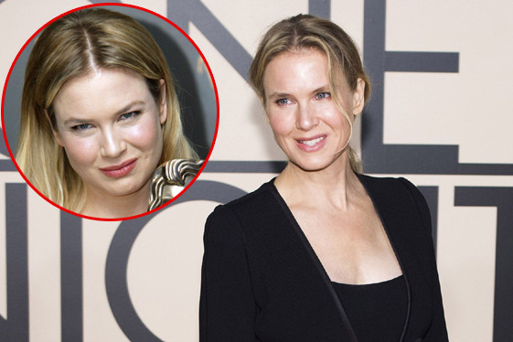 Renee Zellweger cirugía