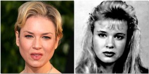 Renee Zellweger cirugía