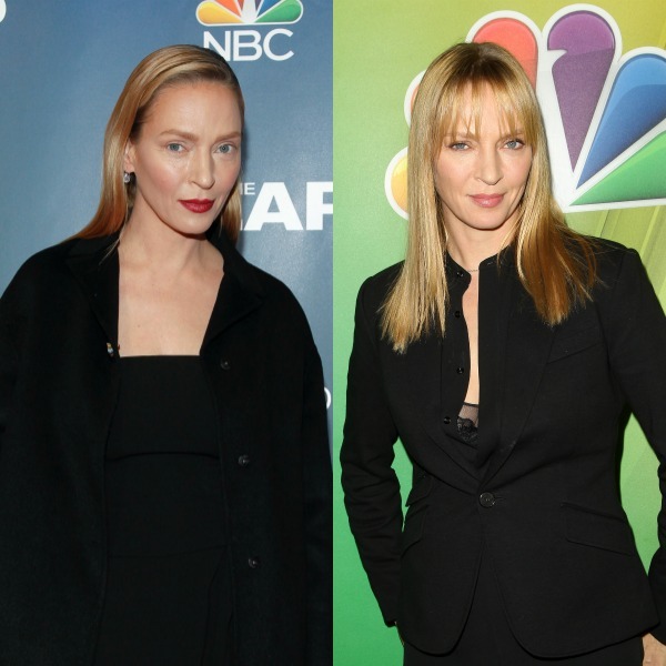 Uma Thurman cirugia estetica