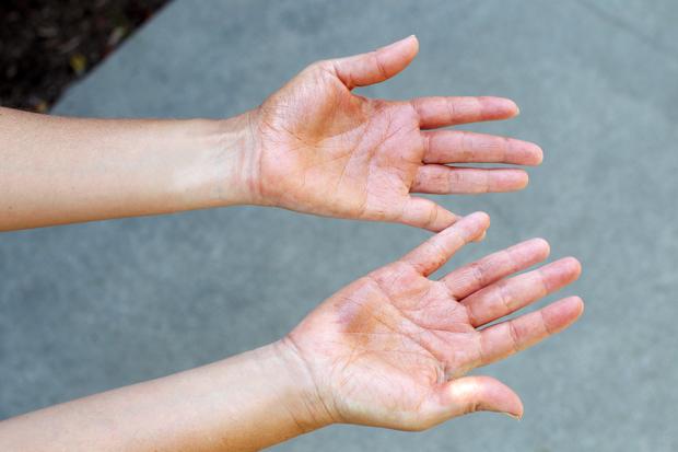 Manchas de autobronceador