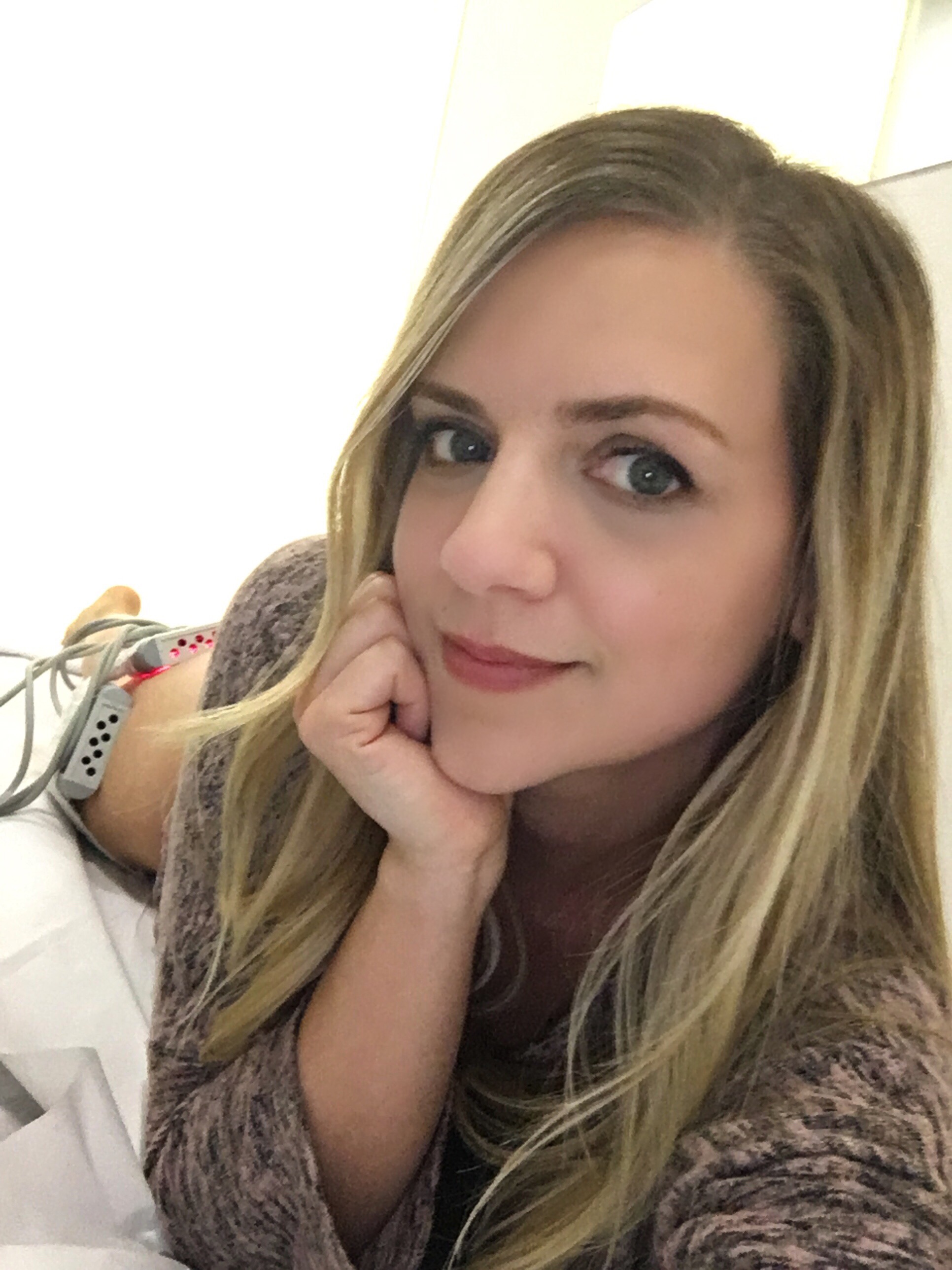 Dermólisis 3D en Clínica Zurich